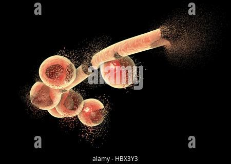 La destruction des champignons Candida, illustration de l'ordinateur. Image peut être utilisé pour illustrer le concept de traitement antifongique. Banque D'Images