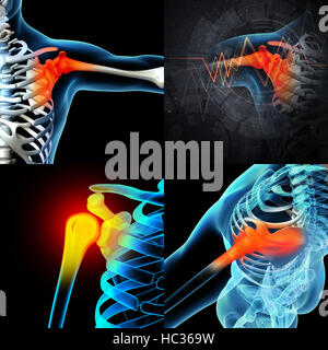 Le rendu 3D de l'épaule avec l'anatomie d'une épaule squelette Banque D'Images