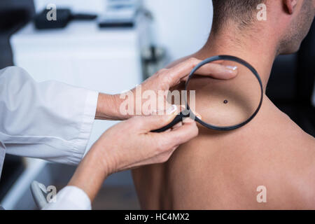 Dermatologist examining mole avec loupe Banque D'Images