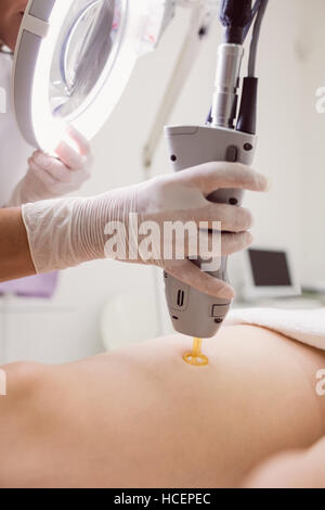 Médecin effectuant l'enlèvement de cheveux de laser sur la peau du patient en clinique Banque D'Images