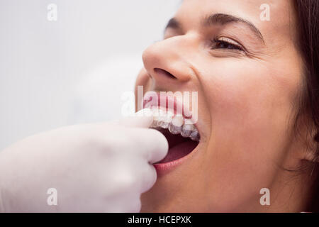 Dentiste aider les patients à porter un appareil dentaire Banque D'Images