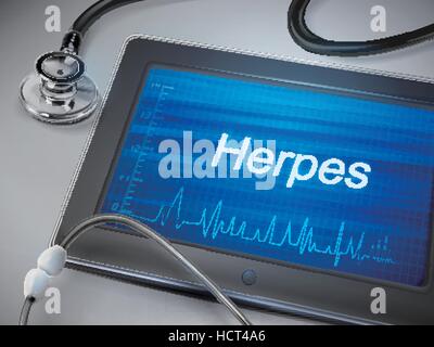 Mot herpès affichage sur tableau sur tablette Illustration de Vecteur