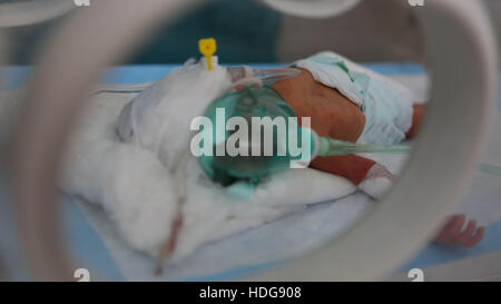 7 décembre 2016 - un bébé prématuré livré avec une naissance par césarienne dans un hôpital de Maarat an-Numan. Sa mère avait été blessé dans un bombardement au populaire marché de Maarat an-Nouman © Muhammad Juma/ImagesLive/ZUMA/Alamy Fil Live News Banque D'Images