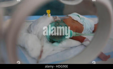 7 décembre 2016 - un bébé prématuré livré avec une naissance par césarienne dans un hôpital de Maarat an-Numan. Sa mère avait été blessé dans un bombardement au populaire marché de Maarat an-Nouman © Muhammad Juma/ImagesLive/ZUMA/Alamy Fil Live News Banque D'Images