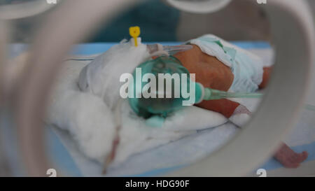 7 décembre 2016 - un bébé prématuré livré avec une naissance par césarienne dans un hôpital de Maarat an-Numan. Sa mère avait été blessé dans un bombardement au populaire marché de Maarat an-Nouman © Muhammad Juma/ImagesLive/ZUMA/Alamy Fil Live News Banque D'Images