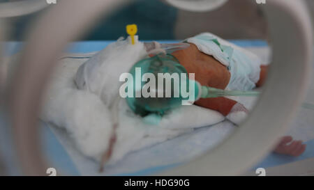 7 décembre 2016 - un bébé prématuré livré avec une naissance par césarienne dans un hôpital de Maarat an-Numan. Sa mère avait été blessé dans un bombardement au populaire marché de Maarat an-Nouman © Muhammad Juma/ImagesLive/ZUMA/Alamy Fil Live News Banque D'Images