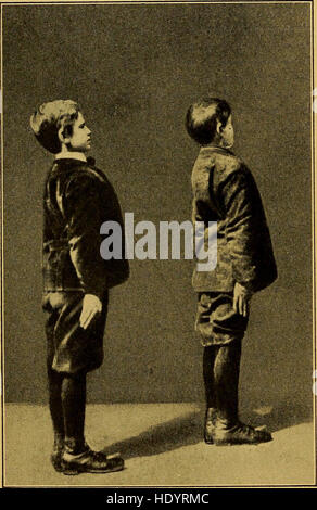 La posture de l'école des enfants, avec son accueil l'hygiène et l'efficacité de nouvelles méthodes pour la formation de l'école (1913) Banque D'Images