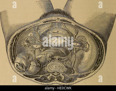*A Treatise on the Science and Practice of Midwifery* (1878) propose une exploration approfondie de l'obstétrique, détaillant les techniques, les pratiques et les progrès dans les soins aux femmes enceintes et l'accouchement à la fin du XIXe siècle. Banque D'Images