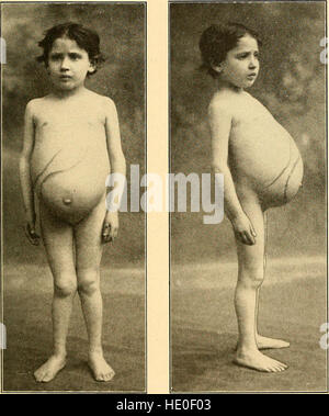 Le diagnostic moderne et le traitement des maladies des enfants ; un traité sur les maladies médicales et chirurgicales de l'enfance et de l'enfance (1911) Banque D'Images