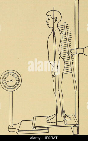 Cette publication de 1916 traite des conditions médicales de courbure latérale de la colonne vertébrale (scoliose) et des épaules rondes (cyphose). Il fournit des informations sur les causes, le diagnostic et les options de traitement de ces déformations posturales, offrant des conseils pour améliorer la posture et la santé de la colonne vertébrale. Banque D'Images