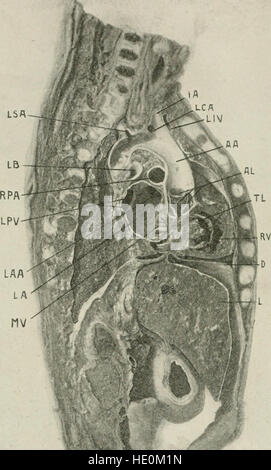 Les maladies de la poitrine et les principes de diagnostic physique (1920) Banque D'Images