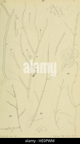 'Die Parasiten der weiblichen Geschlechtsorgane des Menschen und einiger Thiere' (1870) explore les parasites des organes reproducteurs femelles chez l'homme et l'animal, y compris une étude sur Oidium albicans. Il présente des connaissances scientifiques sur les infections parasitaires. Banque D'Images