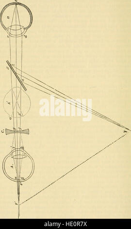*A Treatise on the Diseases of the Eye* (1883) fournit une analyse médicale approfondie des maladies oculaires courantes, de leurs symptômes, de leurs causes et de leurs traitements, offrant un aperçu précoce de l’ophtalmologie. Banque D'Images