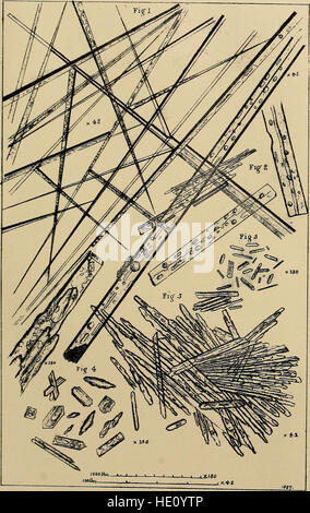 Les maladies du rein, des dépôts, et troubles calculous - leur nature et leur traitement (1870) Banque D'Images