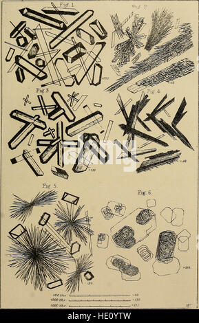 Les maladies du rein, des dépôts, et troubles calculous - leur nature et leur traitement (1870) Banque D'Images