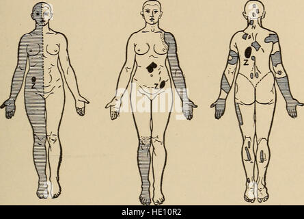 Un traité sur les maladies nerveuses des enfants, pour les médecins et les étudiants (1905)