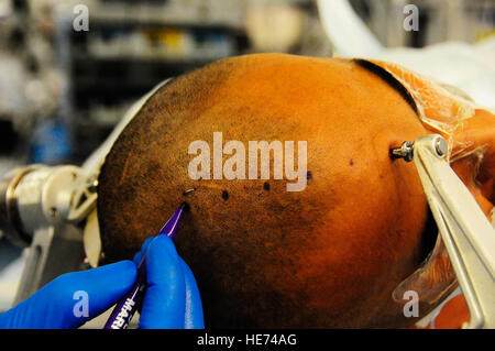 U.S. Air Force Maj Jonathan Forbes, 455 e Escadron expéditionnaire Opérations médicales neurochirurgien marque une tête du patient avant d'effectuer une opération au cerveau à l'hôpital interarmées de théâtre Craig, l'air de Bagram, en Afghanistan, le 10 octobre 2014. Forbes a supprimé une tumeur de 8 centimètres de la tête du patient. Forbes est déployé à partir de Travis Air Force Base, en Californie et natif de New Martinsville, W.V. Le s.. Miguel Lara III Banque D'Images