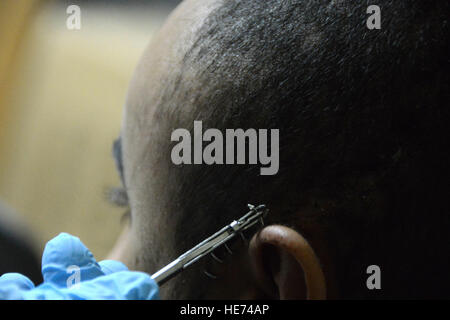 Le Major de l'US Air Force Jonathan Forbes, un neurochirurgien affecté à la 455 e Expeditionary Medical Group, supprime un élément de base de la tête du patient le 22 octobre 2014 Air à Bagram, en Afghanistan. Forbes, déployés à partir de Travis Air Force Base, Californie, retire une tumeur du cerveau de l'homme 12 jours plus tôt. Le sergent-chef. Cohen A. Young Banque D'Images