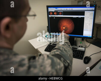 Le sergent de l'US Air Force. Christopher Hutchinson, un technicien d'optométrie avec le 35e Escadron de médecine aérospatiale, examine la rétine d'un patient à Misawa Air Base, Japon, le 21 janvier 2016. "Si vous ne pouvez pas les voir, vous ne pouvez pas tirer sur eux," dit Hutchinson comme il l'a expliqué l'importance du vol de l'optométrie dans la vie d'un membre du service. De la même manière qu'ils soutiennent les combattants sur le terrain dans le but, ils sont également le principal facteur dans une autorisation médicale du pilote à voler. "Sans nous, ils sont littéralement voler en aveugle", dit-il. "Les gens juste ne peut pas voir sans nous." Hutchinson est un Cincinnati, Ohio Banque D'Images