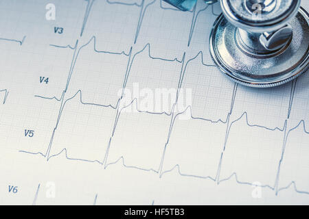 Stéthoscope sur un moniteur cardiaque.Impression graphique d'électrocardiogramme et stéthoscope. Banque D'Images