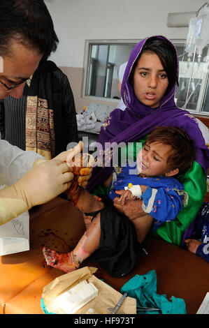 Un médecin de l'Indira Gandhi Institute of Child Health dans le pied d'un garçon afghan pour vidanger l'infection causée après ses pieds ont été brûlés. Les enfants brûlés de dispositifs explosifs improvisés placés dans le sol de l'Afghanistan par les ennemis de la paix, ou à partir de lampes à kérosène qui éclatent dans leurs foyers, rendez-vous à l'Indira Gandhi Institute of Santé de l'enfant, le seul hôpital pédiatrique du pays, située dans la région de Kaboul. La récupération de ces enfants dépend de l'aide internationale les dons. L'hôpital reçoit 400 $ par mois pour exécuter l'ensemble de la place, non pas simplement la brûlure ward. La children's burn ward Banque D'Images