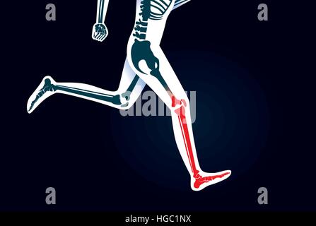 Les droits de l'os de la jambe et du pied en cours d'exécution ont un signal rouge. Illustration de Vecteur