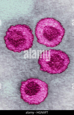 VIRUS VARICELLE-ZONA Banque D'Images