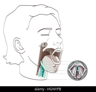 Le larynx, ILLUSTRATION Banque D'Images