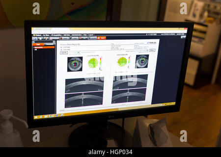 La TOMOGRAPHIE PAR COHÉRENCE OPTIQUE Banque D'Images