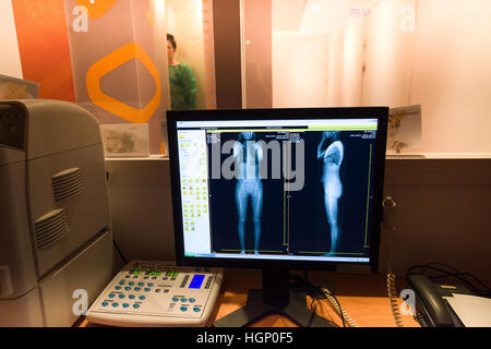EOS X-RAY IMAGING Banque D'Images