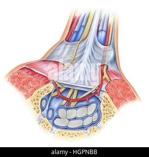 Le syndrome du tunnel carpien est la compression du nerf médian au poignet et a une variété de causes telles que le stress répétitif, ce qui se traduit par une surexploitation micratraum Banque D'Images