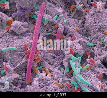 Les bactéries orales. Couleur de l'analyse des électrons Microphotographie (SEM) de bactéries orales. La bouche contient un grand nombre de bactéries, dont la plupart sont inoffensives ou même utiles. Cependant, certaines bactéries peuvent causer des infections de la gorge ou entraîner la formation de dépôts de plaque sur les dents, ce qui peut mener à la décomposition. Jusqu'à 700 espèces de bactéries orales existent avec l'adulte moyen ayant entre 30 et 70 différentes espèces de bactéries dans la bouche. Agrandissement : x5000 à 10cm de haut. Banque D'Images