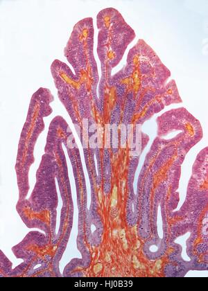 Les trompes de Fallope. La lumière microphotographie (LM) d'une section à travers les trompes de Fallope, ou l'oviducte. Les trompes de Fallope brancher les ovaires à l'utérus. La lumière est vue en haut, doublé d'une muqueuse (violet) qui contient un épithélium cilié et cellules sécrétrices. Ce soutien est une couche vasculaire avec les capillaires et une couche de muscle lisse (rouge). Grossissement : x15 lors de l'impression à 10 centimètres de large. Banque D'Images