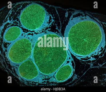 Les fibres nerveuses. La lumière microphotographie (LM) d'une section transversale à travers un bundle (fascicule) des fibres nerveuses. Au sein de chaque fascicule a beaucoup de fibres nerveuses myélinisées. La myéline (vert) est une couche de gras isolante qui entoure les fibres nerveuses appelées axones unique augmentant la vitesse à laquelle les impulsions nerveuses. Soutenir les fibres à l'intérieur de chaque fascicule est l'endoneurium, qui est une forme de tissu conjonctif. Le périnèvre entoure chaque fascicule, qui sont à leur tour liés par epineurial tissus conjonctifs (cyan). Grossissement : x80 lors de l'impression de 10 cm de largeur. Banque D'Images