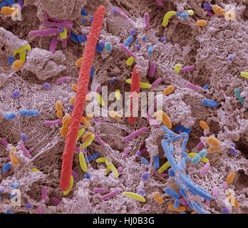 Les bactéries orales. Couleur de l'analyse des électrons Microphotographie (SEM) de bactéries orales. La bouche contient un grand nombre de bactéries, dont la plupart sont inoffensives ou même utiles. Cependant, certaines bactéries peuvent causer des infections de la gorge ou entraîner la formation de dépôts de plaque sur les dents, ce qui peut mener à la décomposition. Jusqu'à 700 espèces de bactéries orales existent avec l'adulte moyen ayant entre 30 et 70 différentes espèces de bactéries dans la bouche. Agrandissement : x5000 à 10cm de haut. Banque D'Images