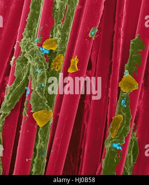 Fil dentaire cire utilisé avec la plaque dentaire (Brown), bactéries (bleu) des cellules de la joue (orange) sur les fibres de soie dentaire (rouge),couleur de l'analyse des électrons Microphotographie (SEM) se compose de Plaque.de bactéries biofilm intégrés dans la matrice matrix.glycoprotéine est formé à partir de la salive des sécrétions bactériennes.l Banque D'Images