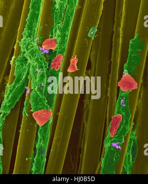 Fil dentaire cire utilisé avec la plaque dentaire (vert), des bactéries (violet) des cellules de la joue (rouge) sur les fibres de soie dentaire (jaune),couleur de l'analyse des électrons Microphotographie (SEM) se compose de Plaque.de bactéries biofilm intégrés dans la matrice matrix.glycoprotéine est formé à partir de la salive des sécrétions bactériennes.l Banque D'Images