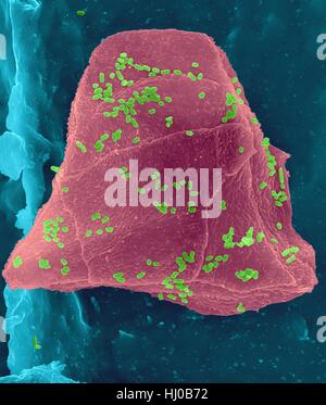 Fil dentaire cire utilisée avec les cellules de la joue (violet) Bactéries (vert) sur les fibres de soie dentaire (bleu),couleur de l'analyse des électrons Microphotographie (SEM).Les cellules joue souvent grattées à l'intérieur de votre bouche lorsque la soie dentaire.De nombreuses bactéries sont présentes dans le cadre de la flore normale de la bouche.plaque bactérienne Banque D'Images