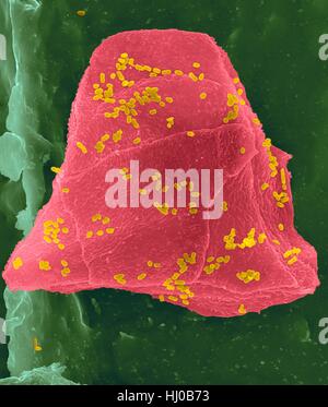 Fil dentaire cire utilisée avec les cellules de la joue (rose) Bactéries (jaune) sur les fibres de soie dentaire (vert),couleur de l'analyse des électrons Microphotographie (SEM).Les cellules joue souvent grattées à l'intérieur de votre bouche lorsque la soie dentaire.De nombreuses bactéries sont présentes dans le cadre de la flore normale de la bouche.plaque bactérienne Banque D'Images