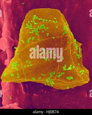 Fil dentaire cire utilisée avec les cellules de la joue (jaune) Bactéries (vert) sur les fibres de soie dentaire (rose),couleur de l'analyse des électrons Microphotographie (SEM).Les cellules joue souvent grattées à l'intérieur de votre bouche lorsque la soie dentaire.De nombreuses bactéries sont présentes dans le cadre de la flore normale de la bouche.plaque bactérienne Banque D'Images