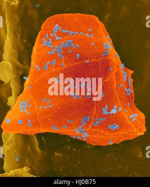Fil dentaire cire utilisée avec les cellules de la joue (orange) Bactéries (bleu) sur les fibres de soie dentaire (brun),couleur de l'analyse des électrons Microphotographie (SEM).Les cellules joue souvent grattées à l'intérieur de votre bouche lorsque la soie dentaire.De nombreuses bactéries sont présentes dans le cadre de la flore normale de la bouche.plaque bactérienne Banque D'Images