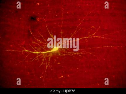 La lumière de fluorescence de micrographie neurone stellaire cortex humain.Ce neurone stellaire a été souillé du colorant fluorescent jaune Lucifer.Le cortex cérébral est la couche de tissu nerveux qui est à l'extérieur du cervelet cerveau cerveau des mammifères.C'est ce qu'on appelle la matière grise du cerveau en raison de fibres nerveuses qui Banque D'Images