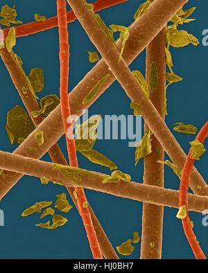 Couleur de l'analyse des électrons Microphotographie (SEM) dander d'animal : chien,cheveux poils de chat chats chien.mort de peau produisent des allergènes.Dander d'animal est matériel libéré de corps de différents animaux (chats chiens communément).Il peut contenir des écailles de peau sèche sèche.substances au sein des squames peuvent provoquer des allergies (allergie Banque D'Images