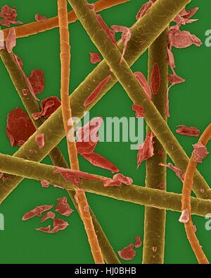 Couleur de l'analyse des électrons Microphotographie (SEM) dander d'animal : chien,cheveux poils de chat chats chien.mort de peau produisent des allergènes.Dander d'animal est matériel libéré de corps de différents animaux (chats chiens communément).Il peut contenir des écailles de peau sèche sèche.substances au sein des squames peuvent provoquer des allergies (allergie Banque D'Images