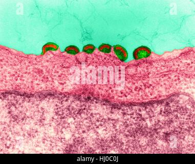 L'infection à VIH de couleur,micrographe (TEM).virus Mature communiqué de bourgeonnement du VIH dans les tissus lymphatiques (ARN du virus,Famille Retroviridae).Dans les bourgeons nucléocapside directement par membrane cytoplasmique.Ce produit des virions enveloppés au cours de processus de libération.LE VIH (human Banque D'Images