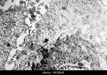 Electronmicrograph montre une section fine contenant le virus Ebola, l'agent causal de la fièvre hémorragique Africaine, 1977. La période d'incubation du virus Ebola varie de 2 à 21 jours avec l'apparition soudaine de la maladie, caractérisée par de la fièvre, maux de tête, des douleurs musculaires et des maux de gorge, faiblesse, et, suivi de la diarrhée, des vomissements et des douleurs à l'estomac. Image courtoisie CDC/Dr. Fred Murphy. Banque D'Images