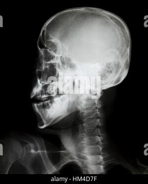 Détail de cou et de la tête x-ray image. Banque D'Images