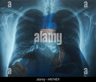 Médecin contrôle x-ray image de l'homme de la poitrine Banque D'Images