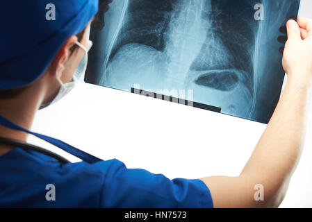 Médecin regarde x-ray image de la poitrine isolated on white Banque D'Images