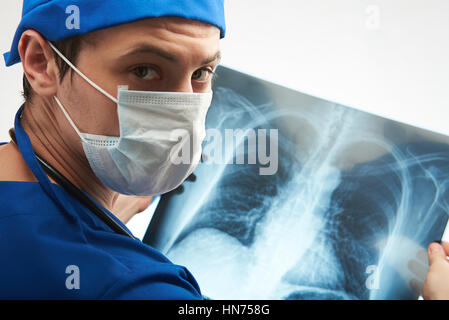 Close up of doctor holding x-ray résultat de poitrine isolated on white Banque D'Images